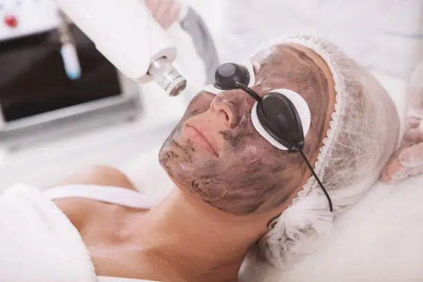 Carbon Laser Facial in Pune