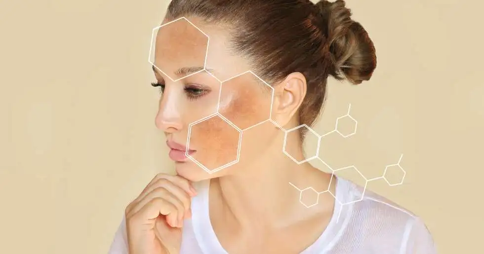 Skin-Pigmentation-Treatment-in-Pune