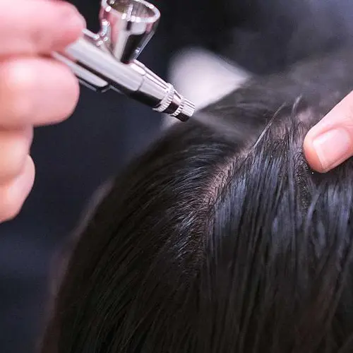 procedure involved in dandruff treatment at Bodysutra Clinic