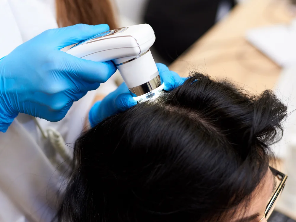 Advanced Skin Clinic in Pimple Saudagar for Skin & Hair Treatments 14 Weak hair roots and breakage treatment