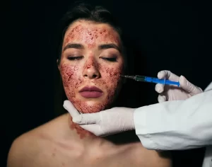 Blog 85 Vampire Facial Benefits Are They Too Good to Be True- fetaured image- banner image