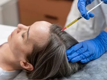 White Hair Removal Treatment